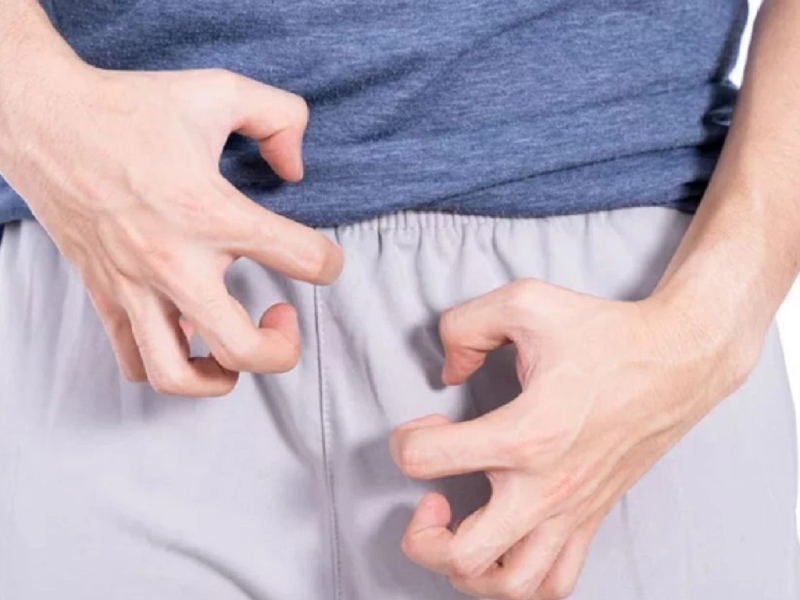 Viêm nang lông vùng kín nam - 5 mẹo khắc phục siêu nhanh Giữ vùng kín luôn khô thoáng và vệ sinh