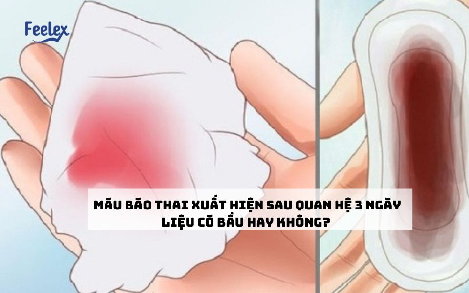 Máu báo thai xuất hiện sau quan hệ 3 ngày