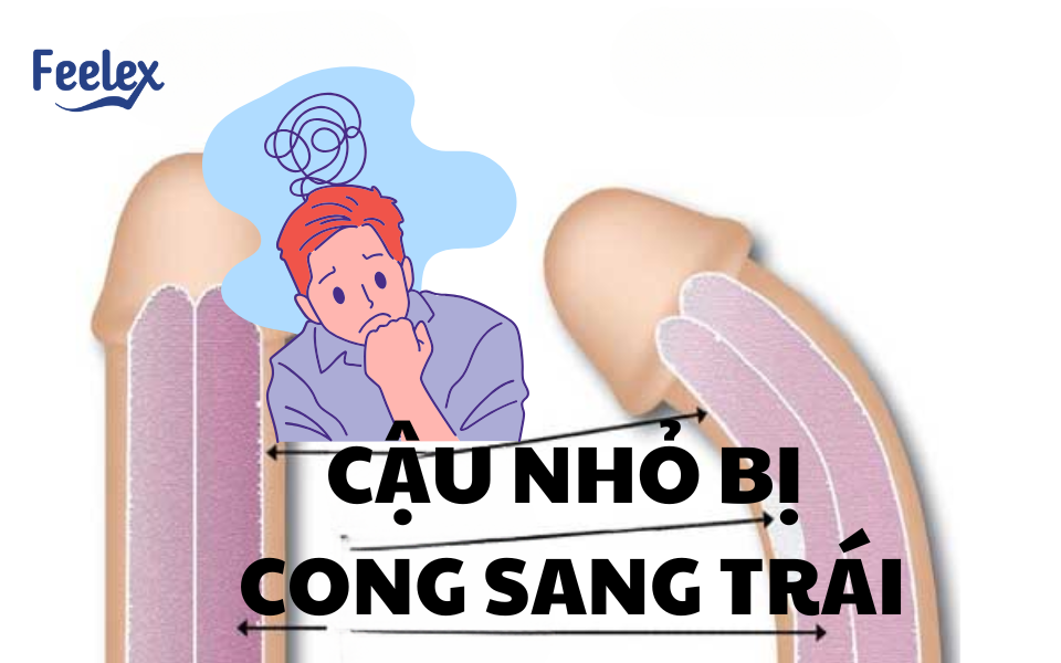Cậu nhỏ bị cong sang trái