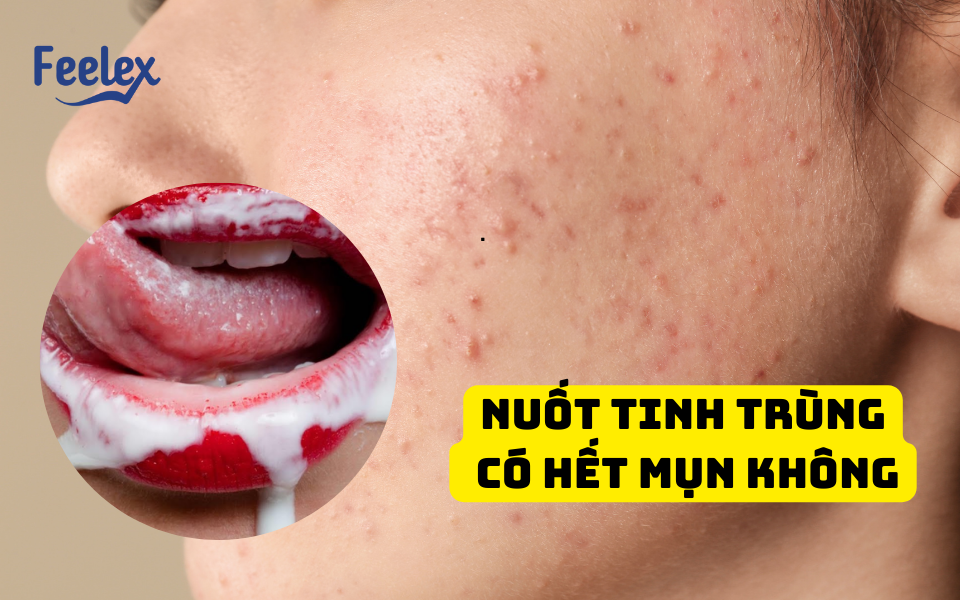 Nuốt tinh trùng có hết mụn không