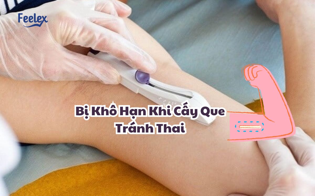 Bi Kho Han Khi Cay Que Tranh Thai