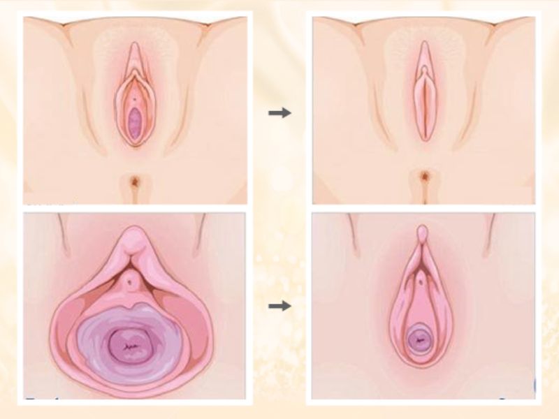 9 cách kích thích âm vật tăng khoái cảm hiệu quả cho nữ giới Các bước kích thích âm vật siêu nhanh