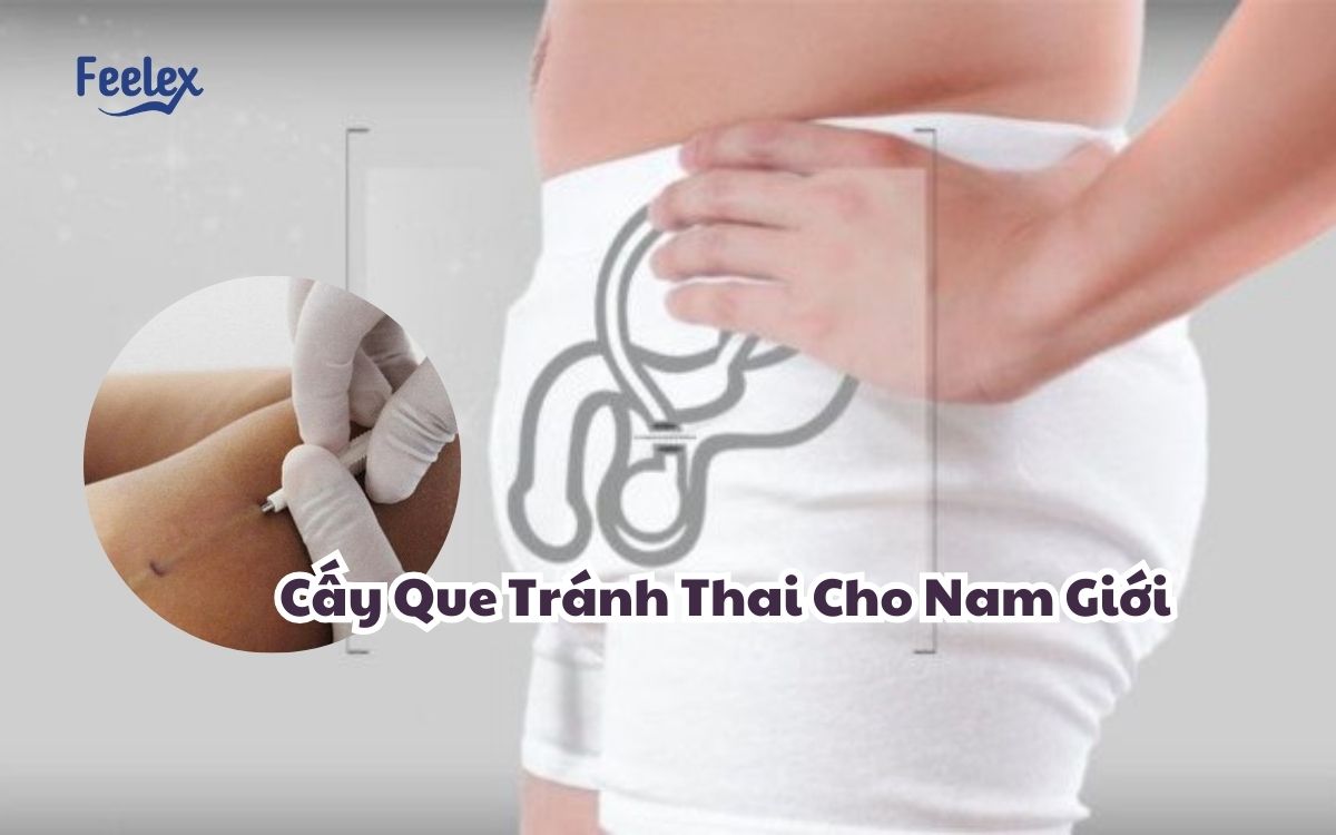 Cay Que Tranh Thai cho nam gioi