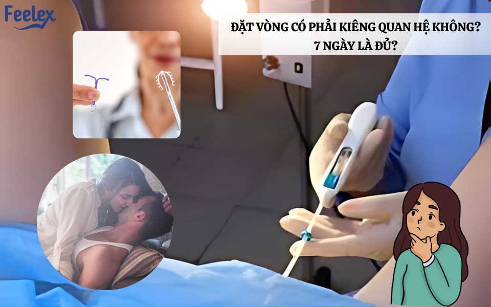 Đặt vòng có phải kiêng quan hệ không