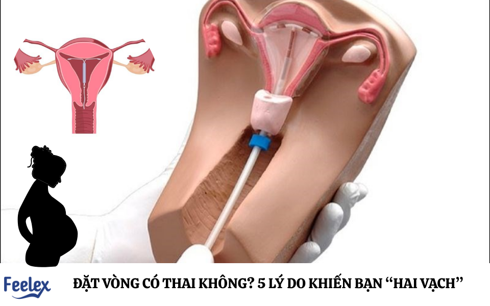 Đặt vòng có thai không