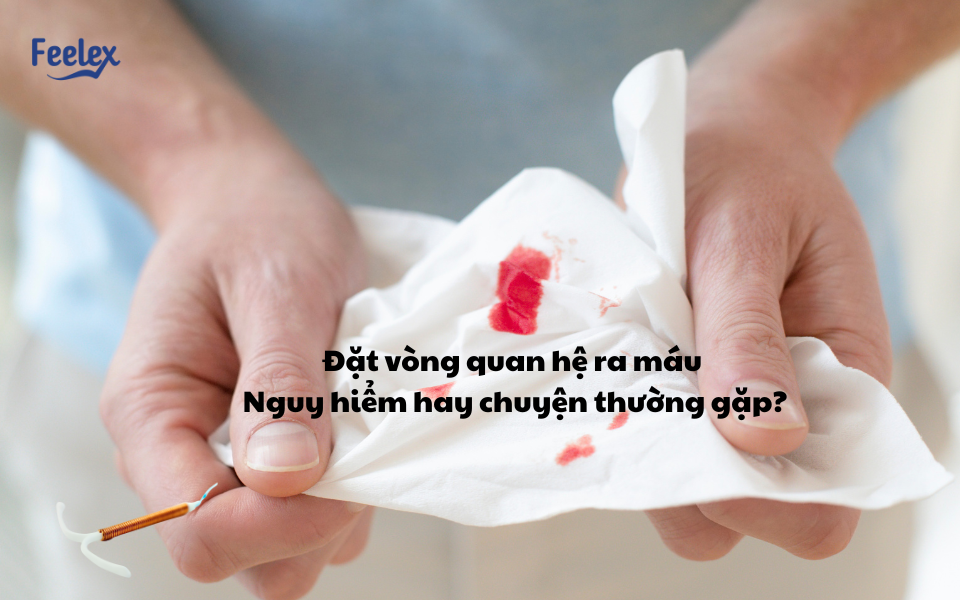 Đặt vòng quan hệ ra máu