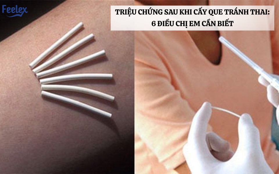 Triệu chứng sau khi cấy que tránh thai