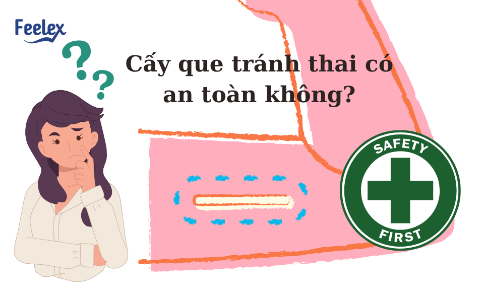 Cấy que tránh thai có an toàn không