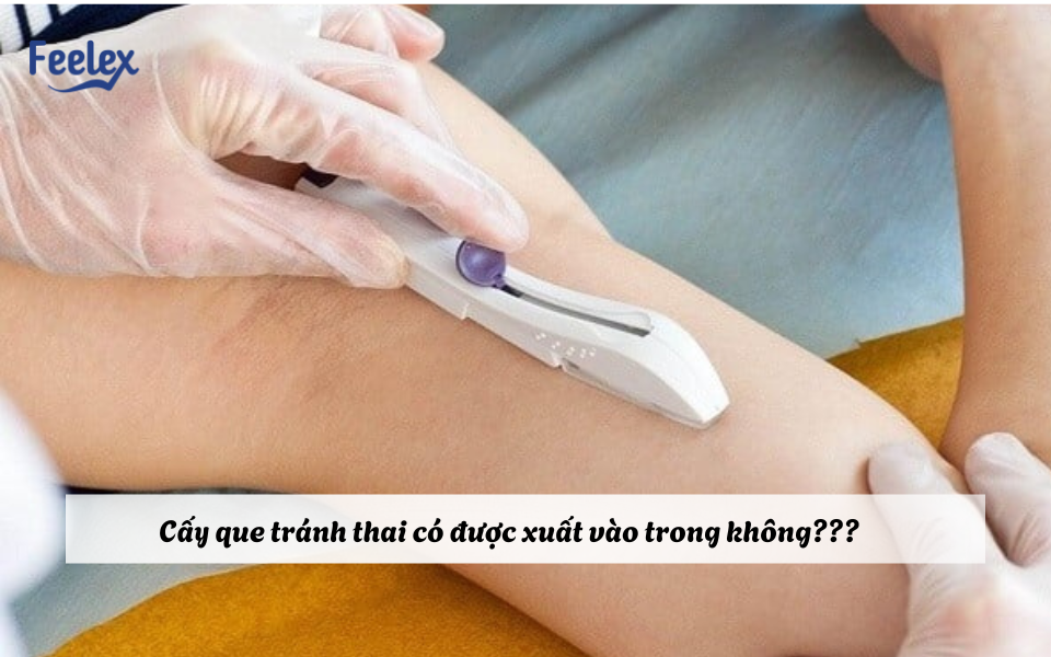 cấy que tránh thai có được xuất vào trong không