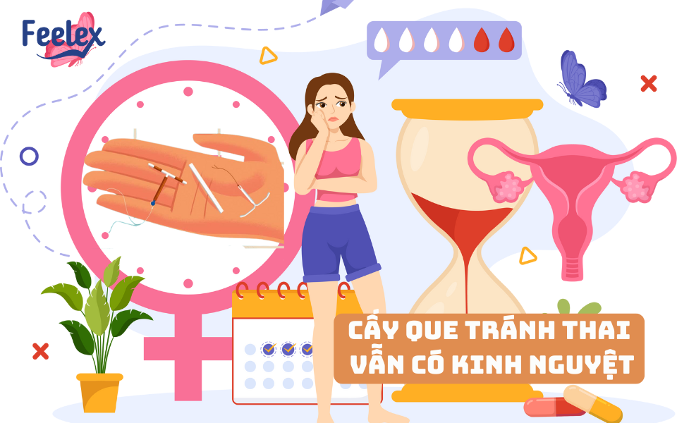 Cấy que tránh thai vẫn có kinh nguyệt