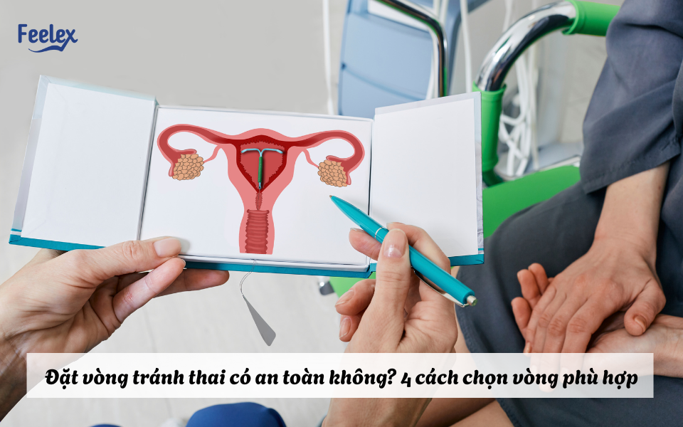 Đặt vòng tránh thai có an toàn không?