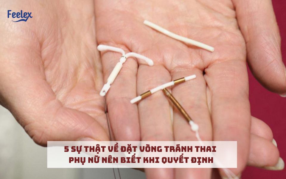 Đặt vòng tránh thai