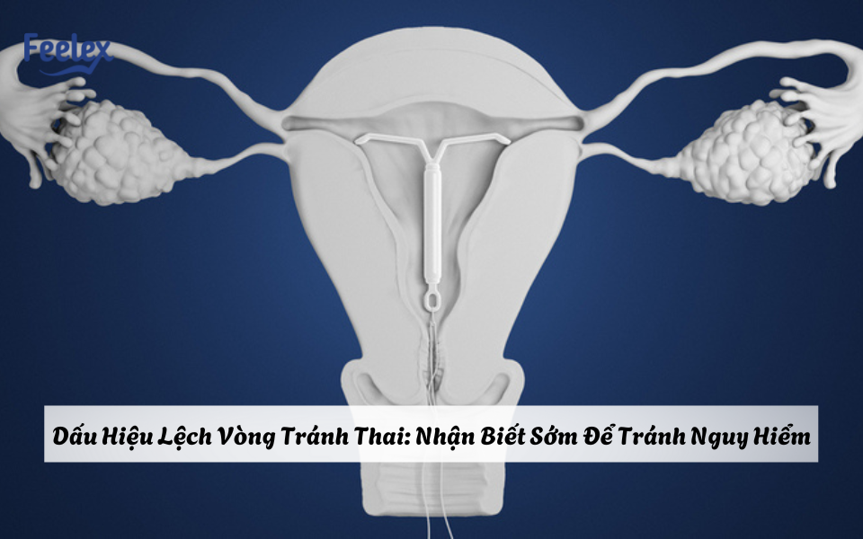 Dấu hiệu lệch vòng tránh thai