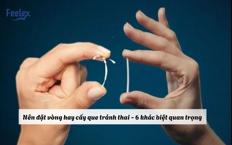 Nên đặt vòng hay cấy que tránh thai