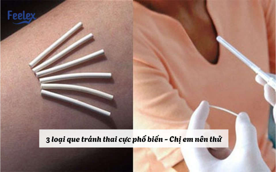 Nên đặt vòng hay cấy que tránh thai