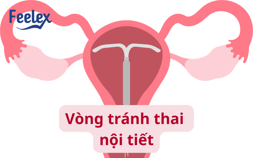 Vòng tránh thai nội tiết