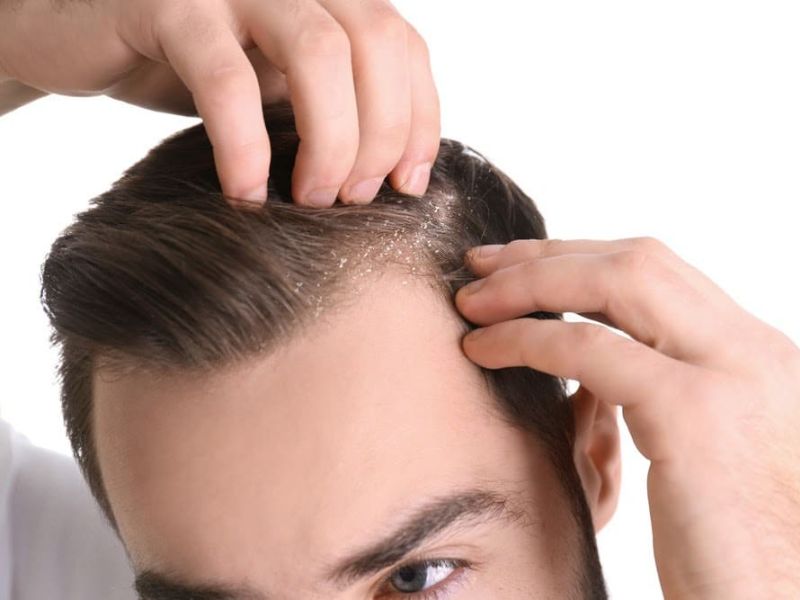 Cách Gội Đầu Lâu Bết: 5 Bước Giữ Tóc Sạch, Thơm Lâu Cho Nam Giới Cách gội đầu lâu bết hiệu quả nhất