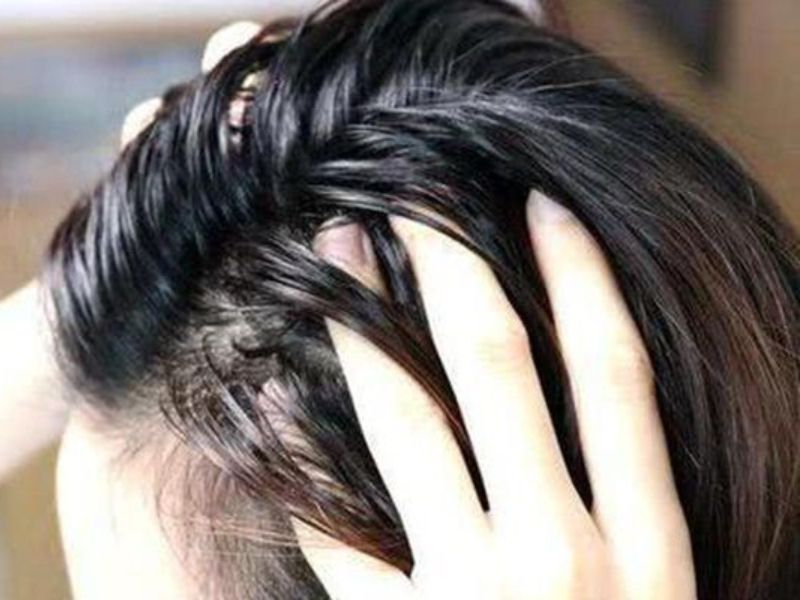 Tóc Nhanh Bết Nên Dùng Dầu Gội Nào? Top Sản Phẩm 2025 Tai Sao Toc Nhanh Bet Luon La Noi Am Anh