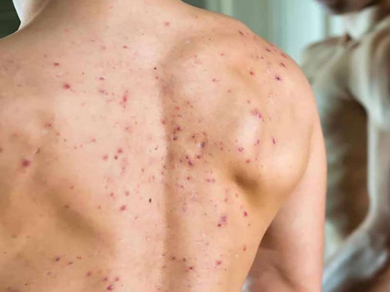 TOP 6 sữa tắm cho da nhờn nam: Không còn mụn lưng, không còn bết dính Thoi quen ho tro giup kiem soat dau nhon