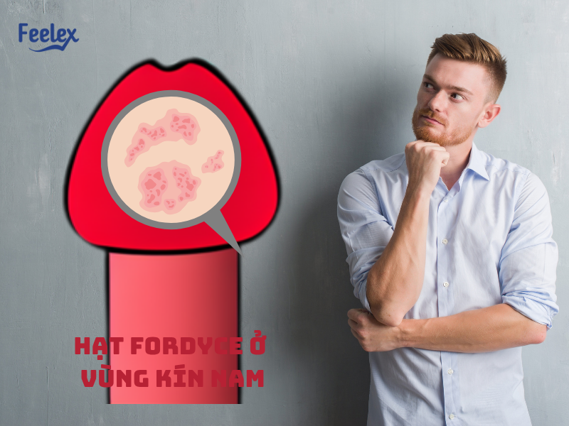 Hạt fordyce ở vùng kín nam