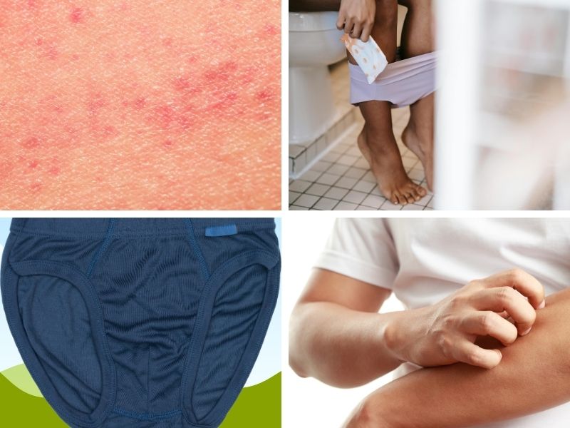Ngứa vùng kín nam càng gãi càng ngứa: Top 4 mẹo giảm ngứa tức thì! 4 lý do khiến ngứa vùng kín nam càng gãi càng ngứa