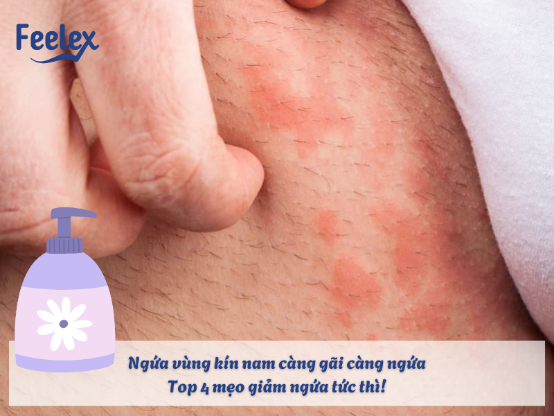 Ngứa vùng kín nam càng gãi càng ngứa