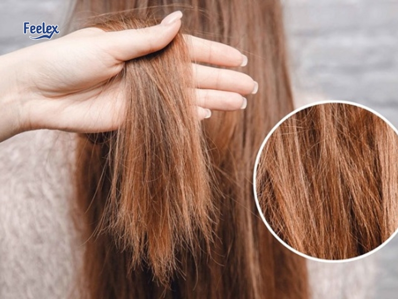 7 Điều Cần Biết Về Tóc Chẻ Ngọn: Nguyên Nhân, Cách Khắc Phục & Phòng Ngừa toc-che-ngon-co-phuc-hoi-duoc-khong
