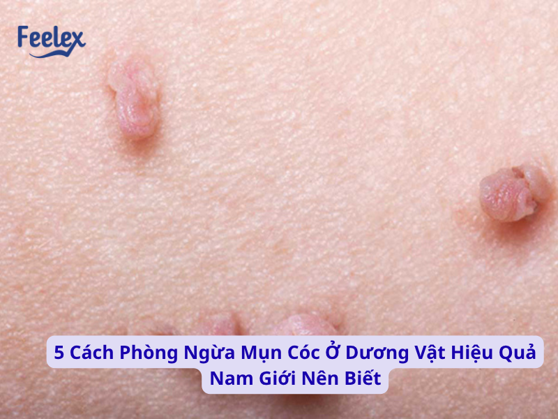 mun coc o duong vat
